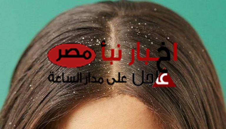 وصفات طبيعية للتخلص من قشرة الشعر